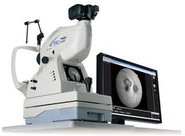 Topcon Retinal Cameras